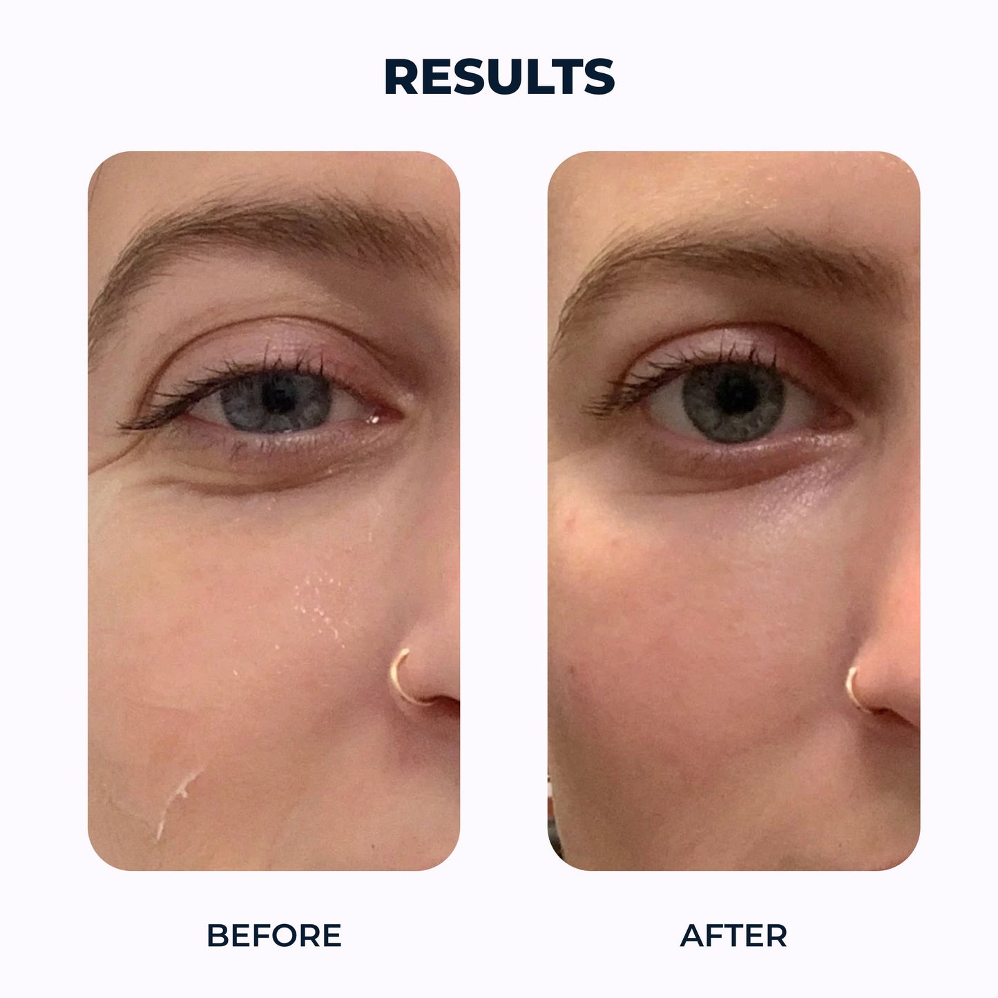 Lovio™ Nanofiber Collagen Eye Revitalizer